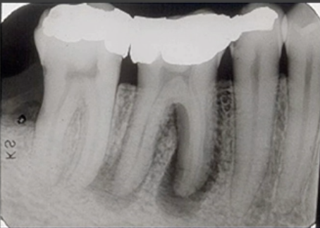 <p>how would you describe the internal structure of this lesion</p>