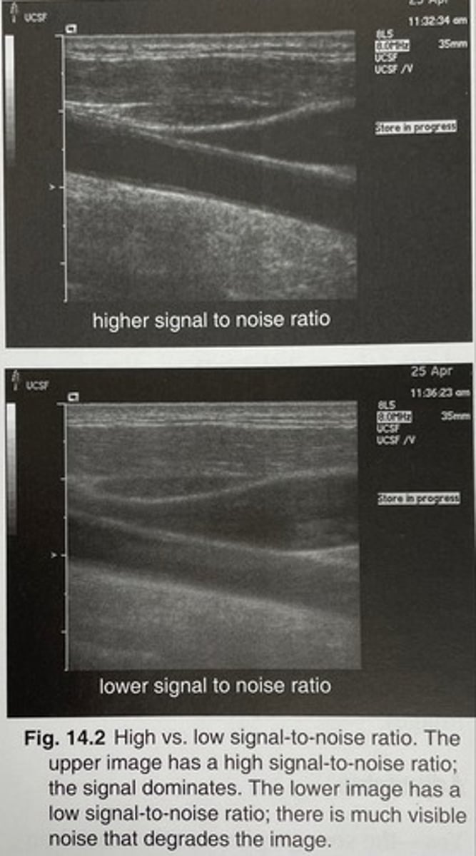 <p>a comparison of the meaningful information (signal) and the amount of noise</p>