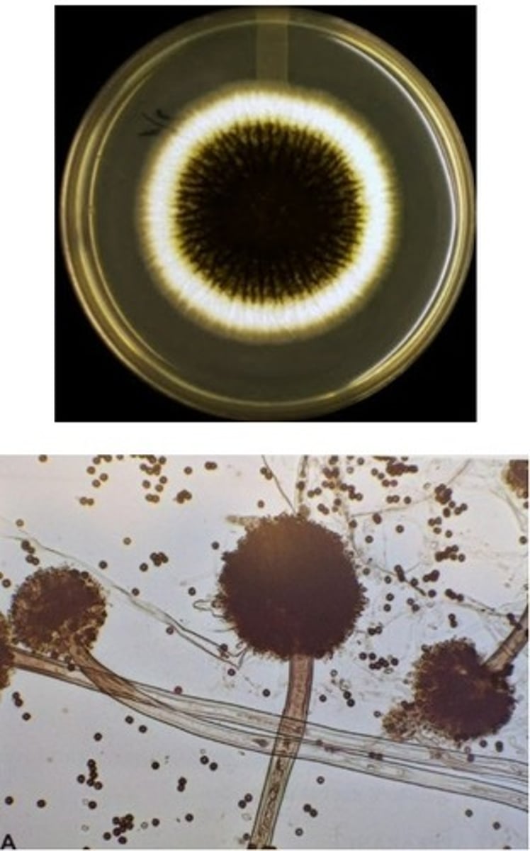 <p>• Dark brown/black colonies</p><p>o Light reverse side</p><p>• Vesicle has two rows of</p><p>phialides covering the whole</p><p>surface</p><p>• Black conidia</p>