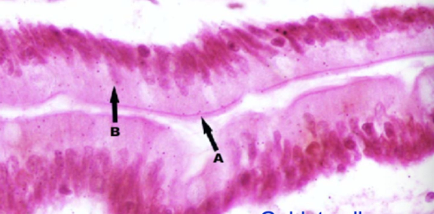 <p>what type of epithelium is shown</p>