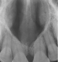 <p>diagnosis?</p>