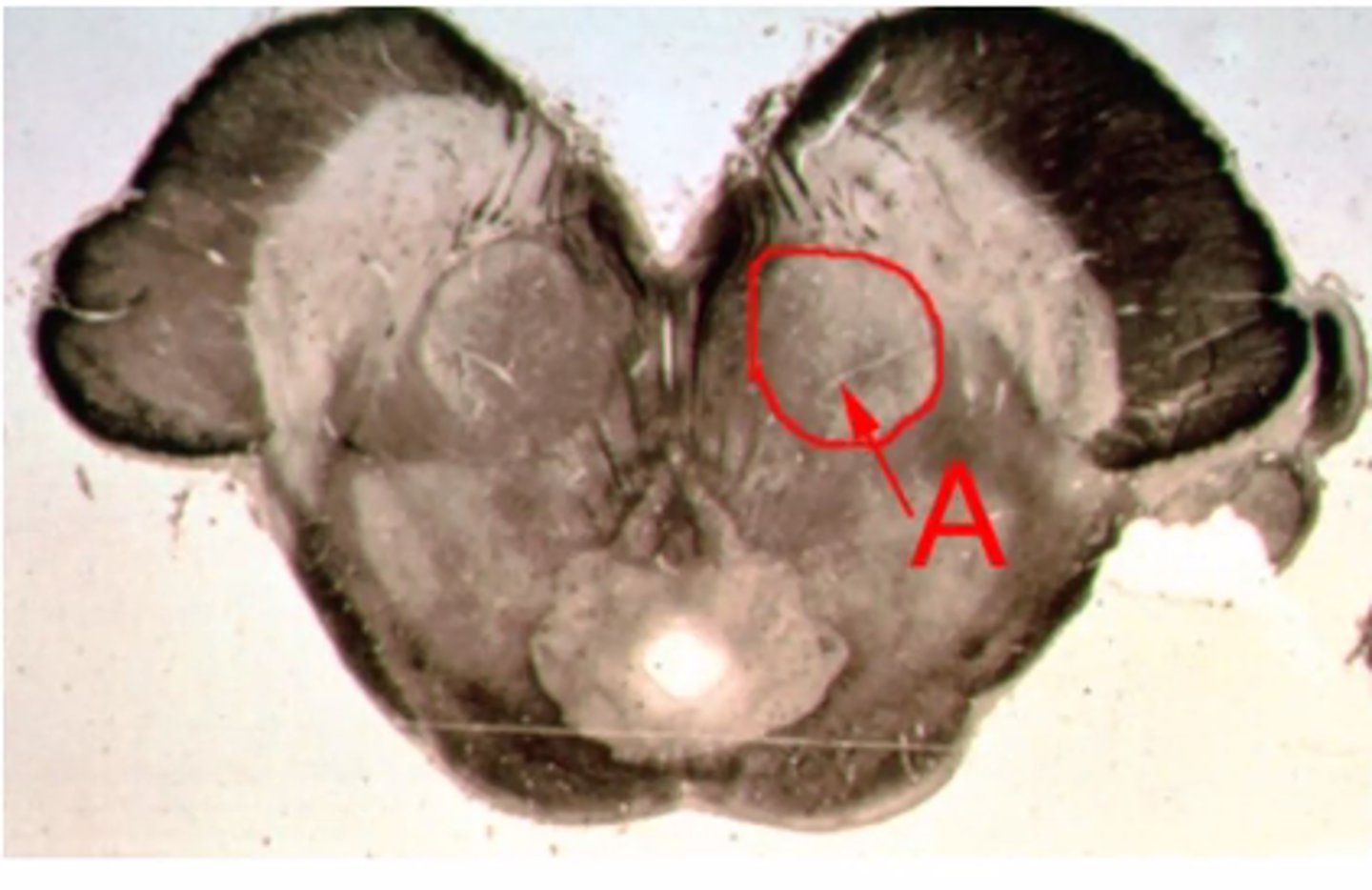 <p>Identify the structures indicated by the outline and letter "A"</p>