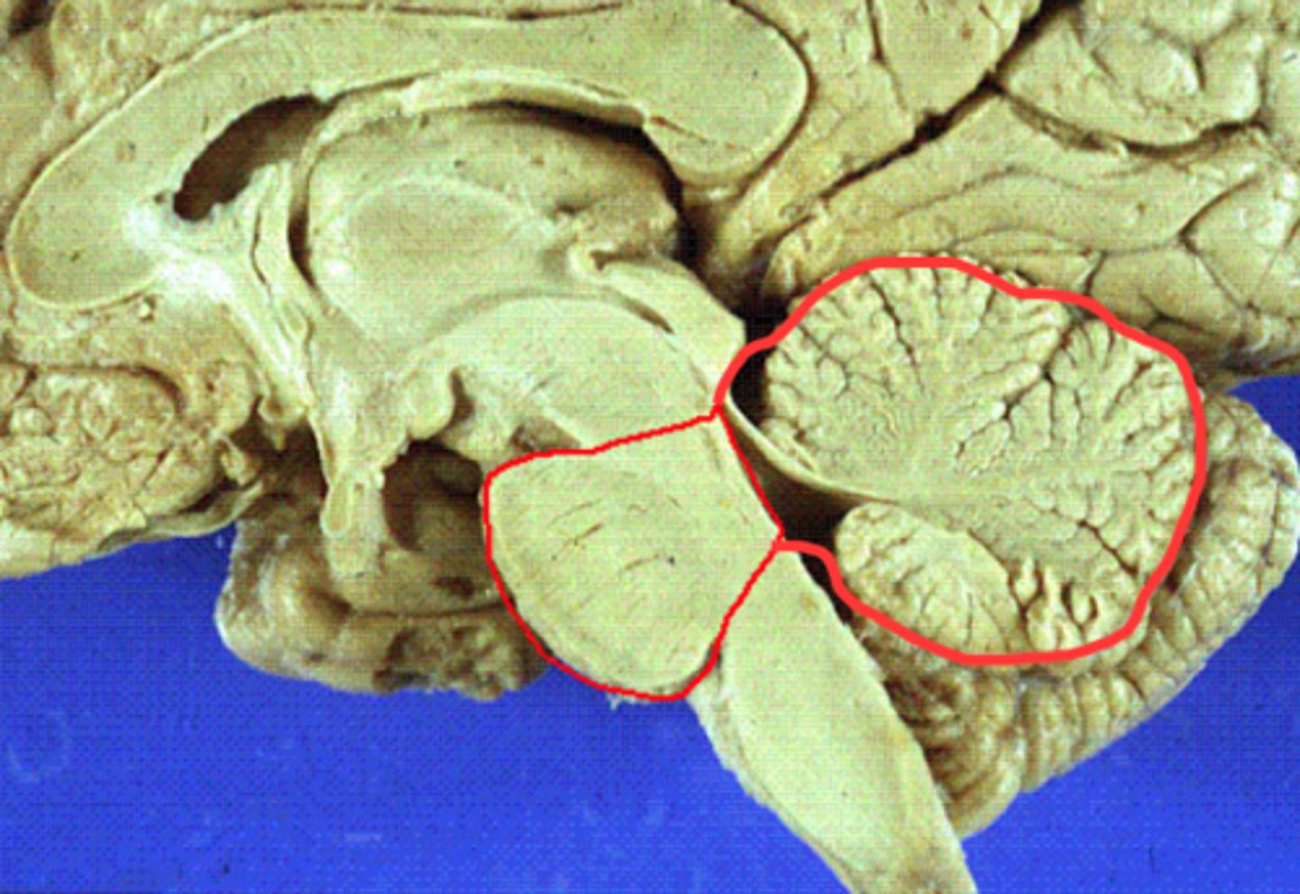 <p>pons and cerebellum</p>