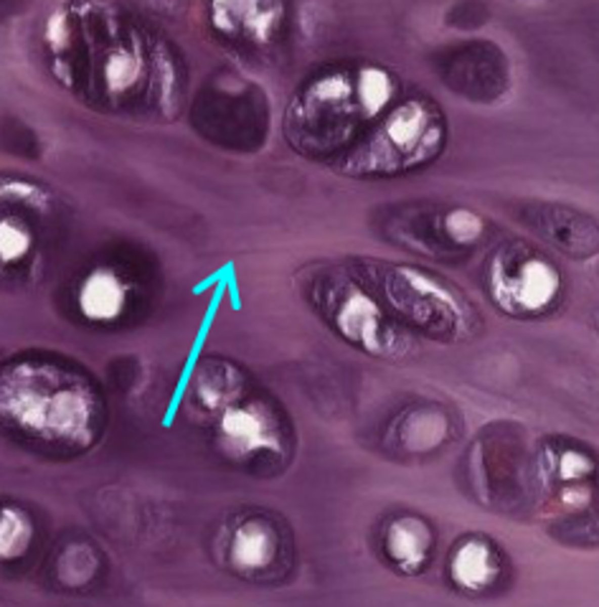 <p>What is the interterritorial matrix in cartilage ECM?</p>