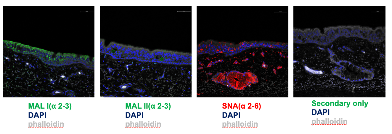 <p><strong>Hemagglutinin (HA)</strong></p><ul><li><p>Mediates virus attachment and entry based on whether or not that specific HA can bind to specific <strong>sialic acids </strong>(alpha 2,3 or alpha 2,6) found on the surface of that mammal’s cells </p></li><li><p>Determines the virus’ host range </p></li></ul><p></p>