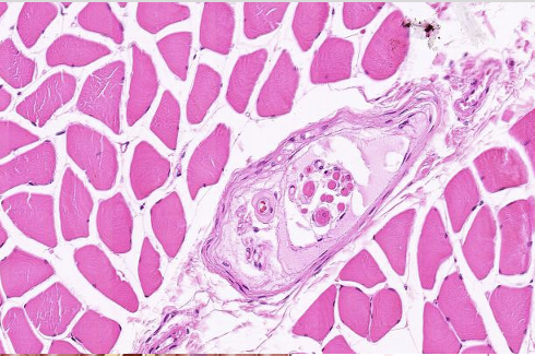 <p>What is found in the middle of this skeletal muscle? What nerve fibers does it contain?</p>