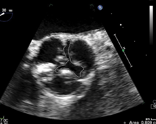<p>tracing ao valve border to get an area </p>