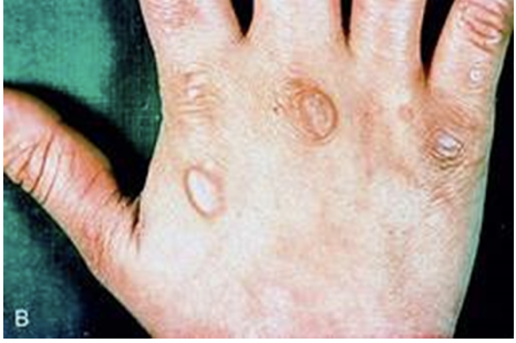 <p><span>How would you document this assessment finding?</span></p><p></p>