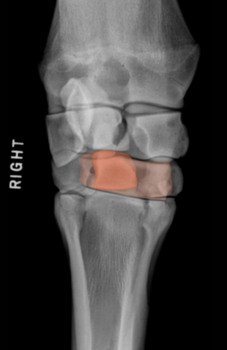 <p>What bone is highlighted?</p>