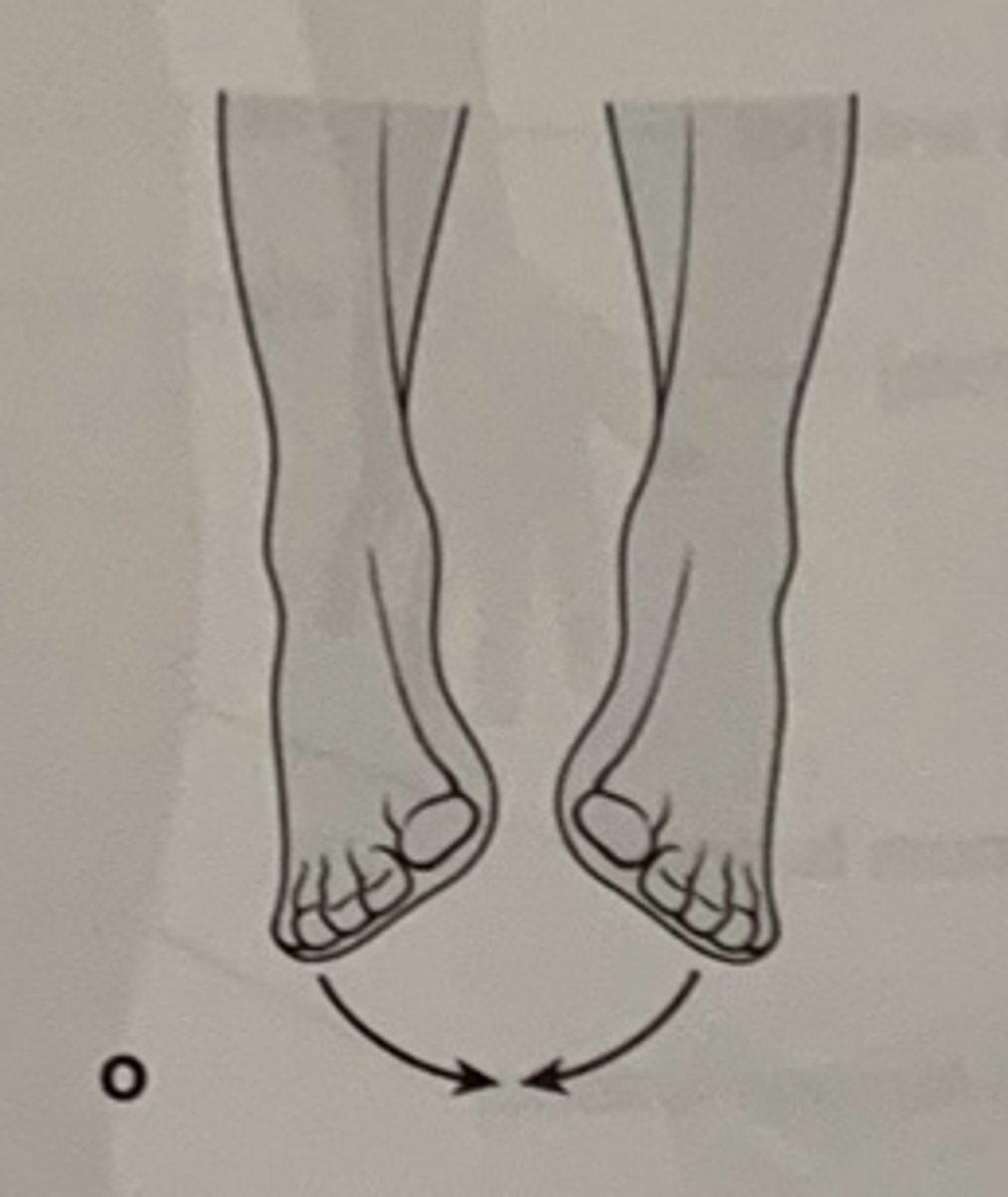 <p>Hvilken anatomisk bevægelse ses her?</p>