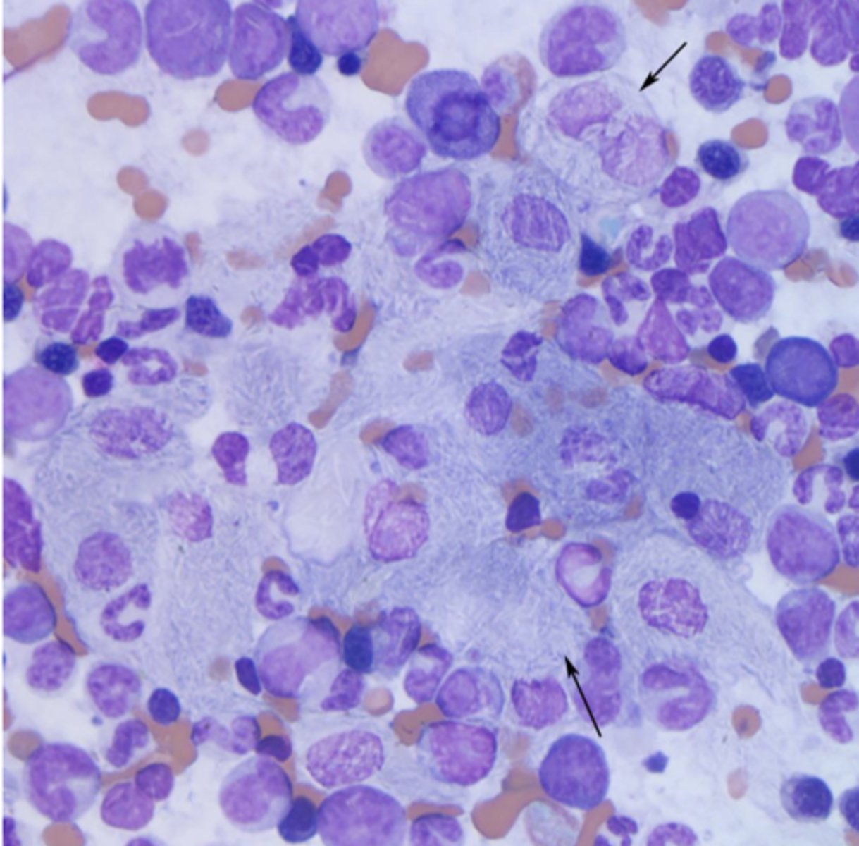 <p>What type of inflammation is this?</p>