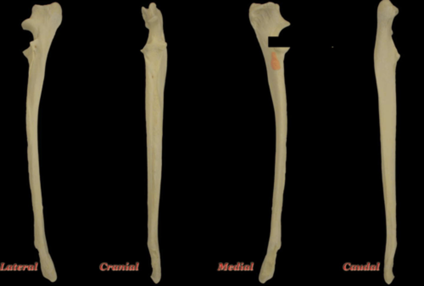 <p>What structure is highlighted in this picture?</p>