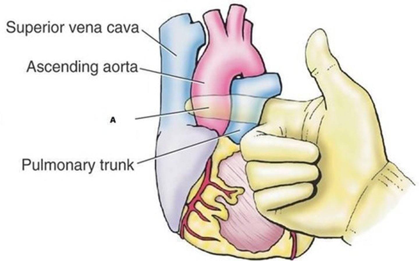 <p>transverse sinus of pericardium</p>