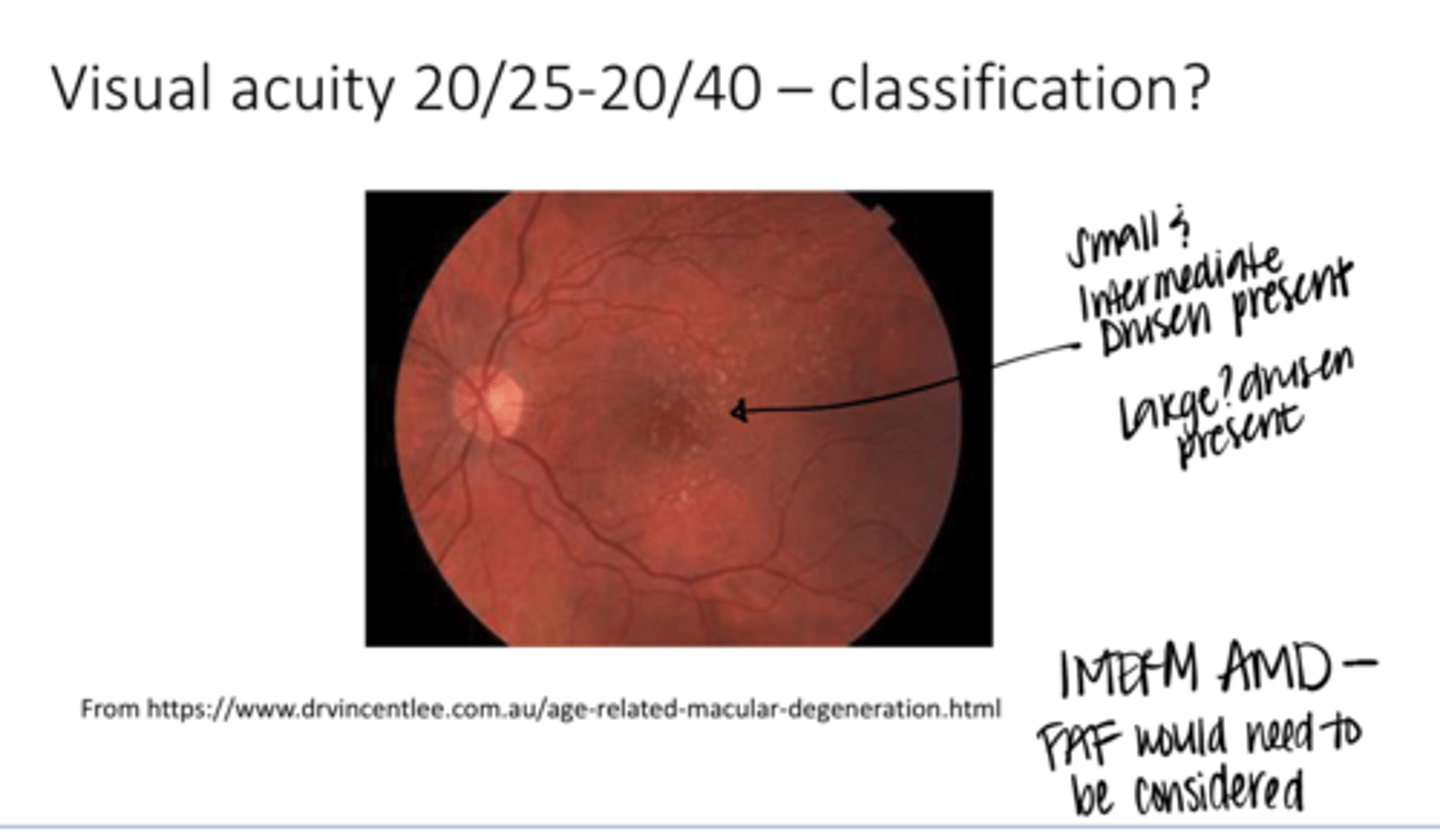 <p>Visual Acuity is 20/25-20/40. What is the classification of this AMD? (See Pic)</p>
