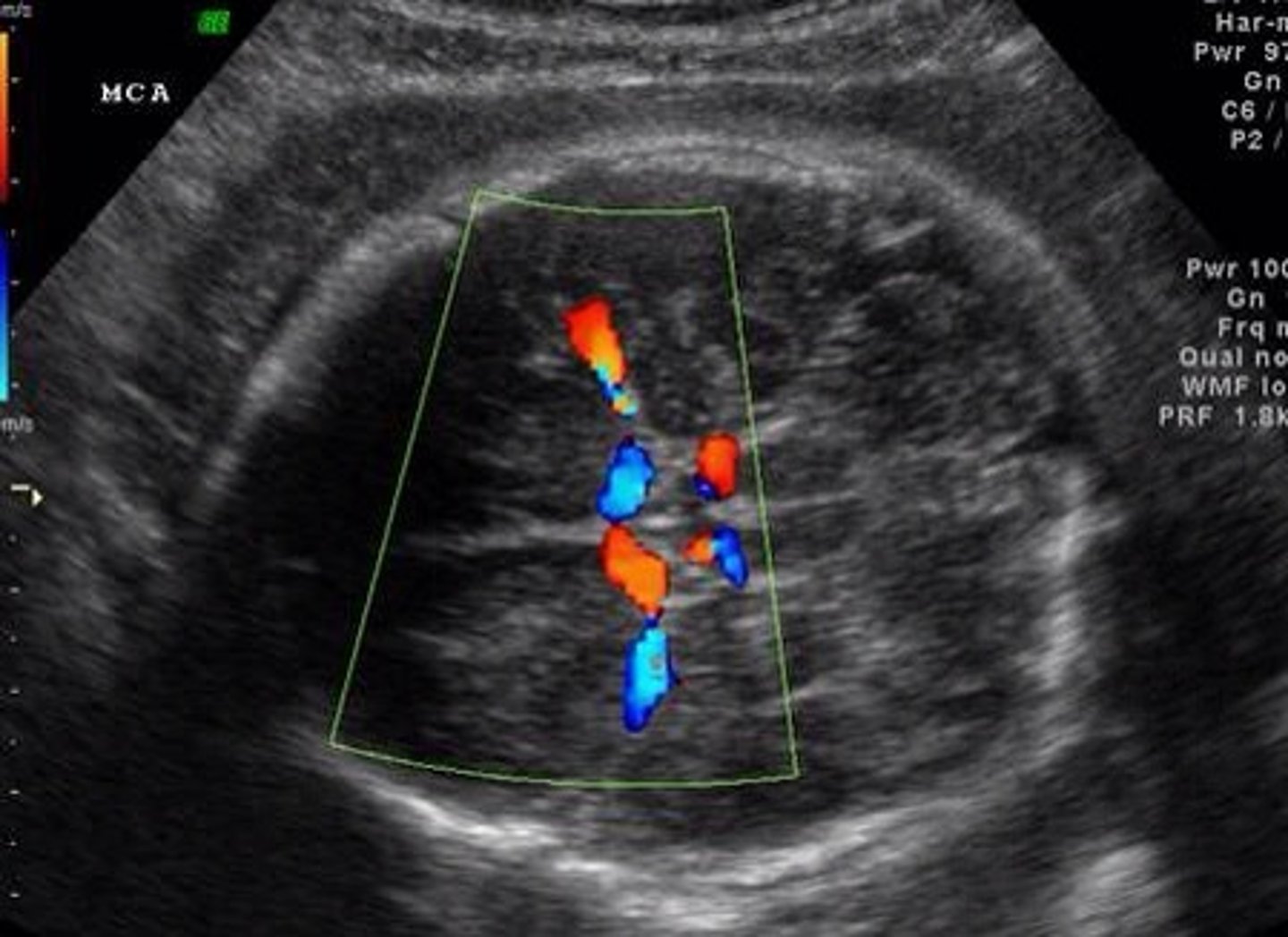 <p>What are the 2 things Real-Time Imaging (doppler mode) can do? </p>