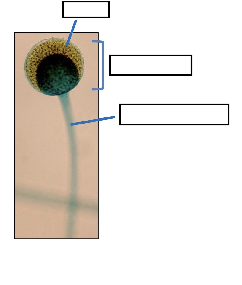 <p>Label the spores, sporangium and sporangiophore. Is this sexual or asexual reproduction? Identify this fungi.</p>