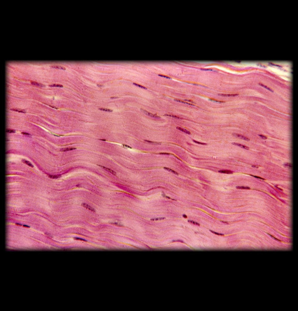 <p>- Parallel bundles of collagen fibers.</p><p>- Provides tensile strength in one direction.</p><p>- Appears as neat, parallel waves of collagen fibers.</p><p>- Found in tendons and ligaments.</p>