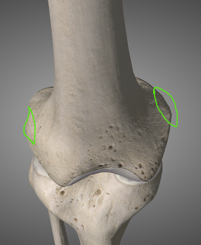 <p>reisiluun ulkosivunasta</p>