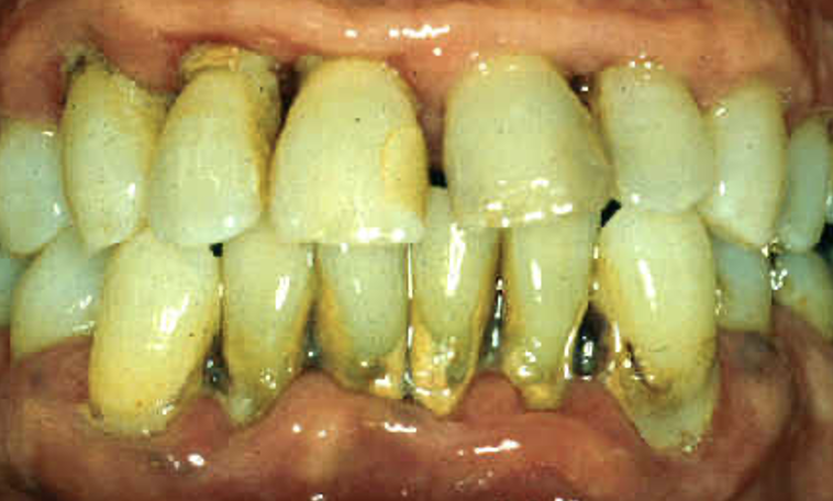 <p>outline notable aspects about this patient</p>