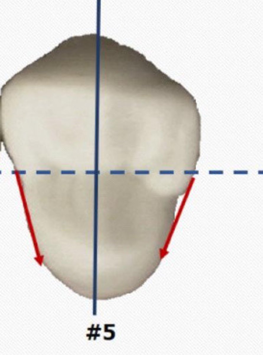 <p>Only slight lingual taper</p>