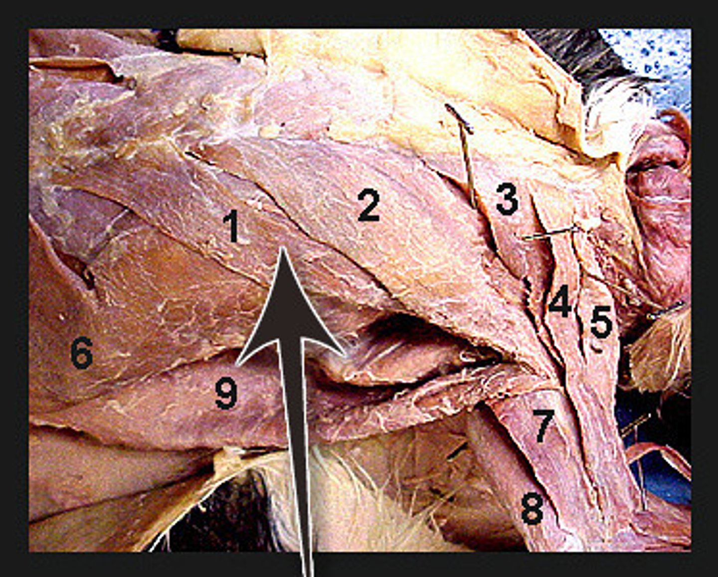 <p>Identify what the arrow is pointing to</p>