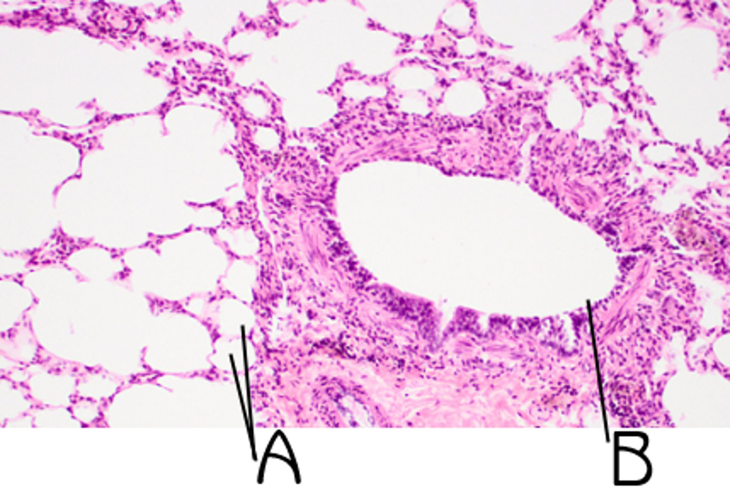 <p>terminal- transition from ciliated simple columnar to nonciliated simple cuboidal; goblet cells decreasing</p><p>lose goblet cells before cilia</p><p>respiratory- simple cuboidal; no cilia; no goblet cells</p>