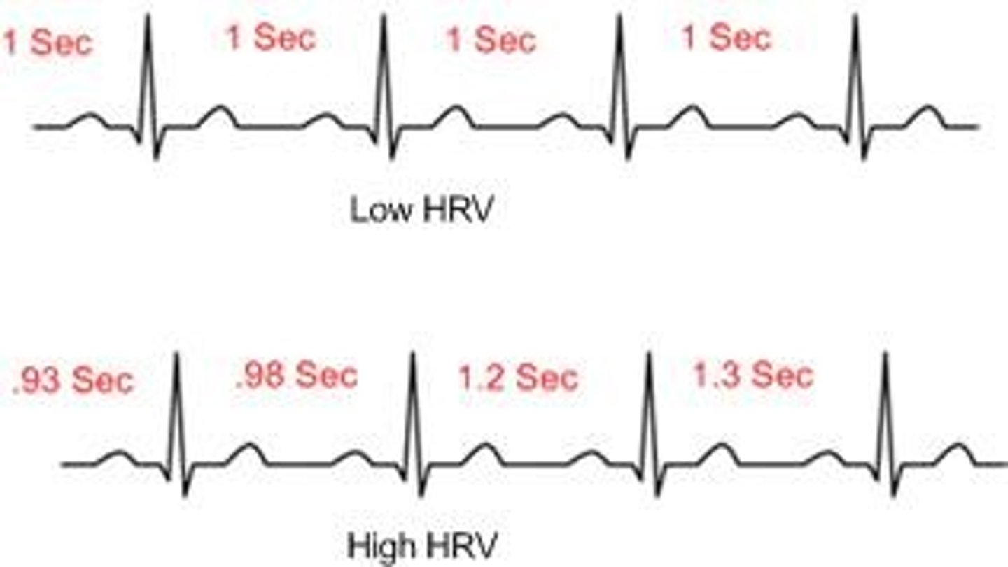 <p>The interval between each heartbeat. High HRV is beneficial.</p>