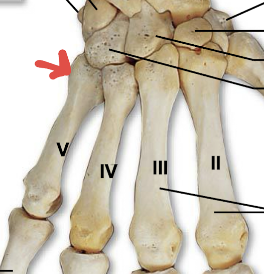 <p>what is this part of the metacarpals?</p>
