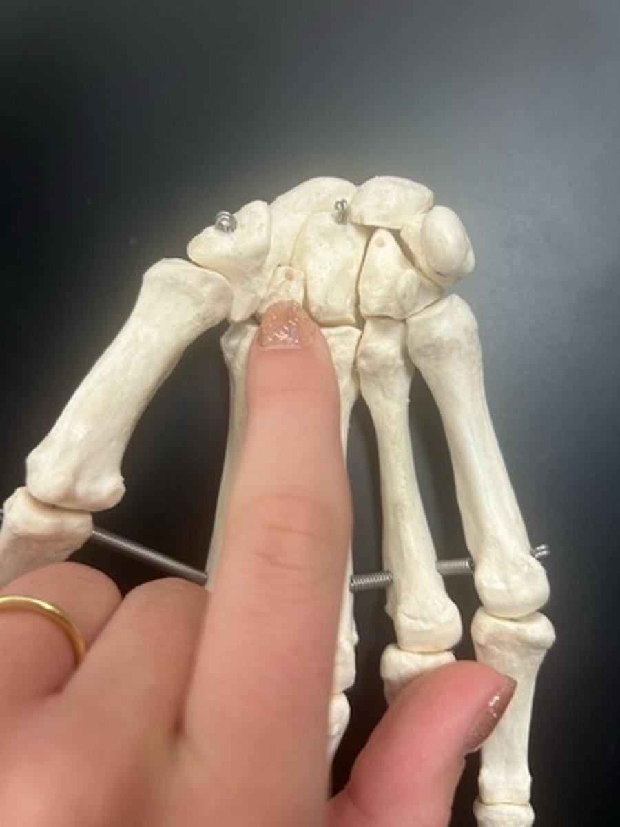 <p>name the bone</p>