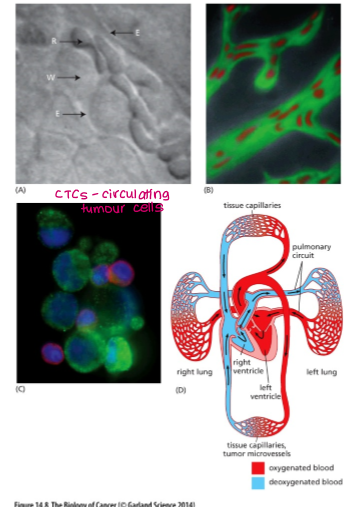 <p>platelets</p><p>They rapidly <strong>coat tumour cells</strong>, forming platelet–tumour aggregates that <strong>shield CTCs from immune recognition and stress.</strong> </p><p>Platelet-derived adhesion molecules help CTCs <strong>attach to the endothelium</strong>, facilitating arrest and subsequent extravasation at distant sites.</p>