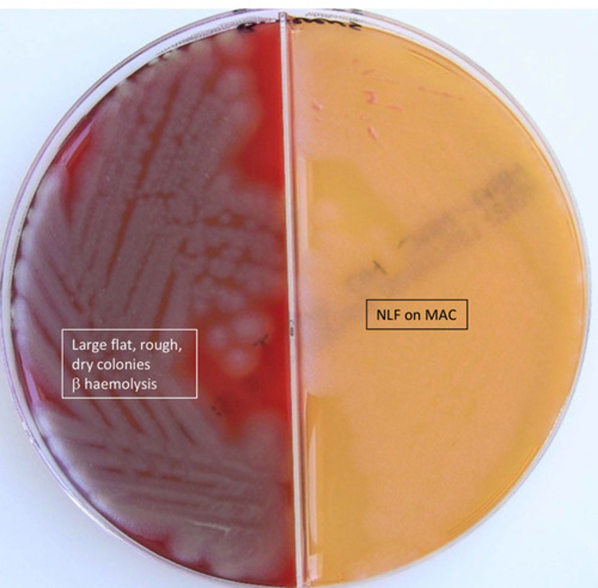 <p>GPB, catalase pos, beta haemolytic, anaerobic, motile, spores</p>