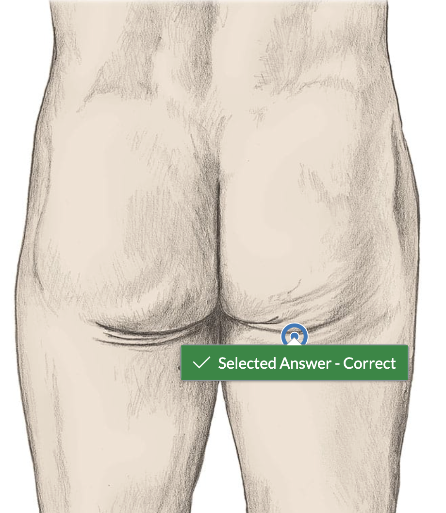 <p>bottom right butt cheek </p>