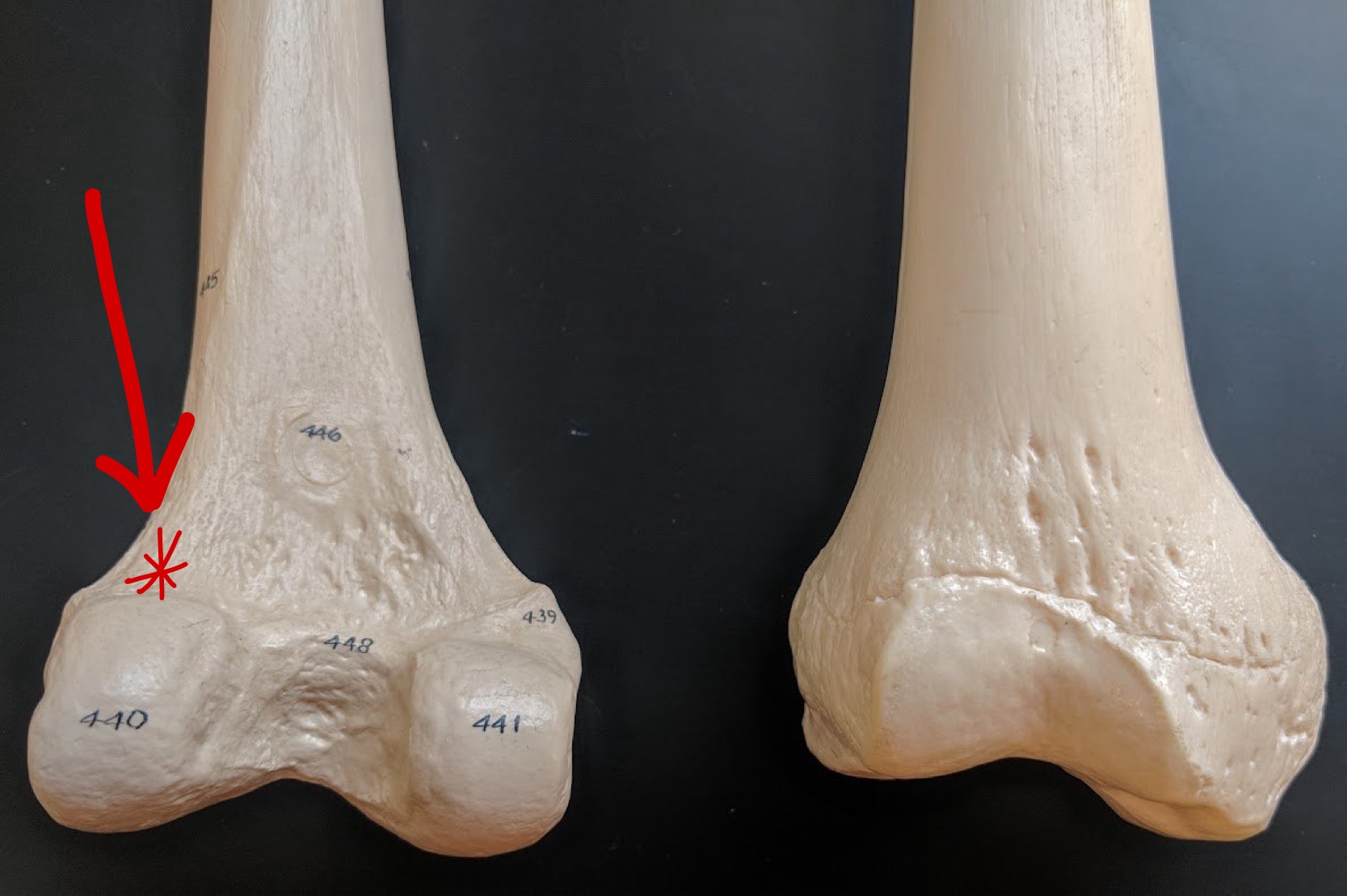 <p>Name this structure</p>