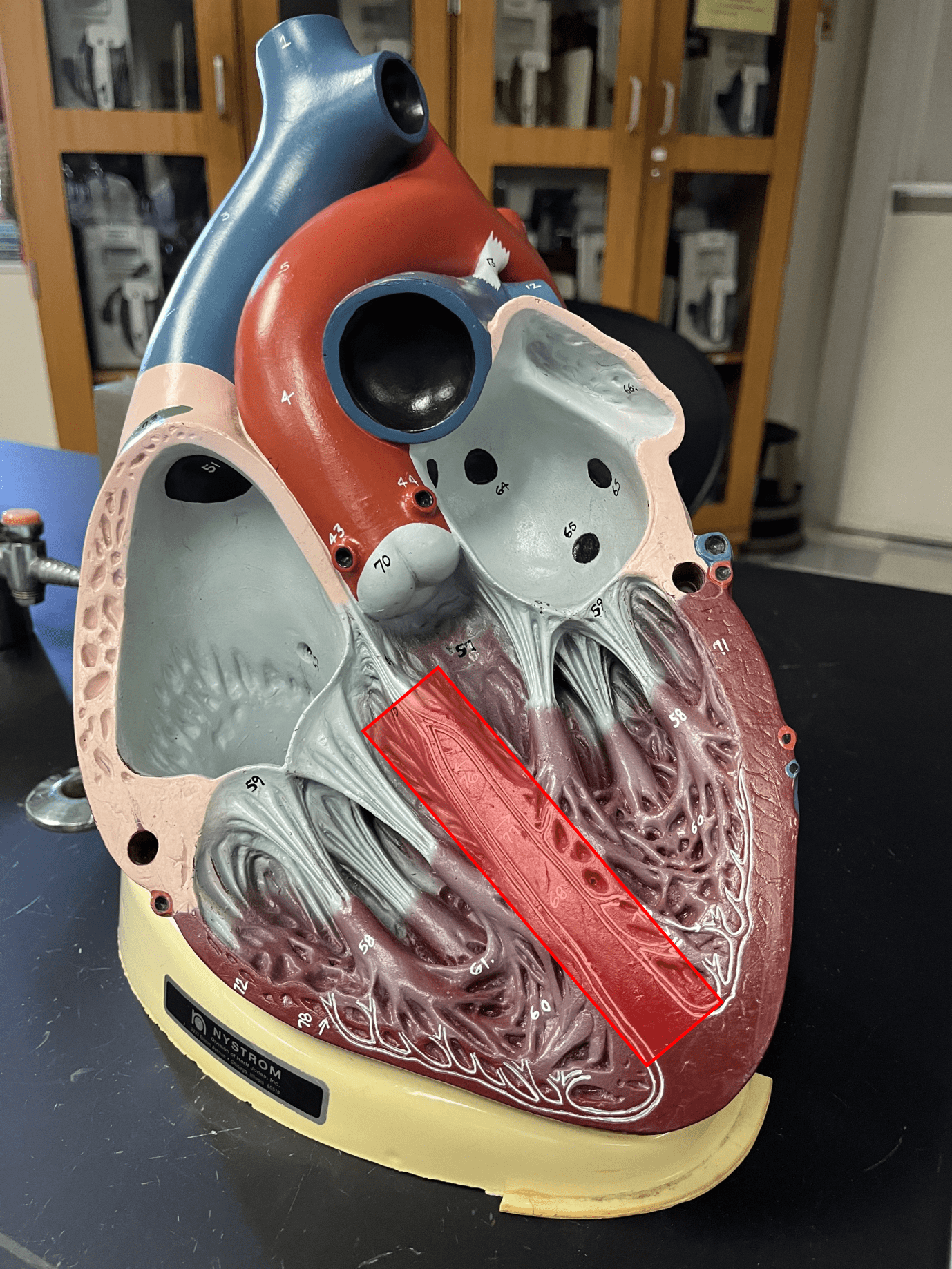 Separates the right and left ventricles of the heart.