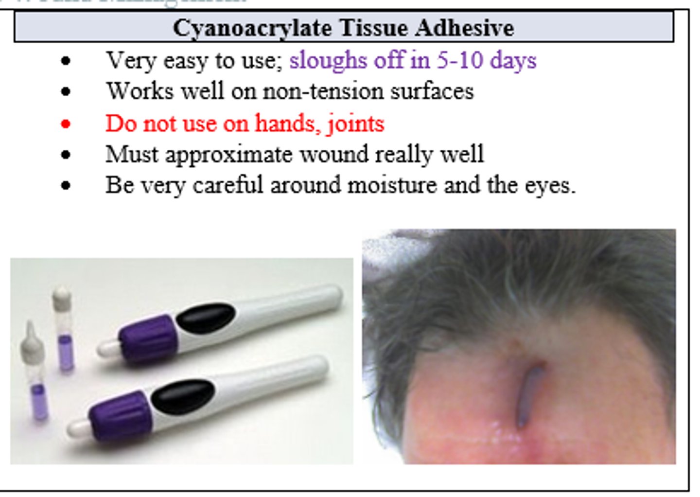 <p>Cyanoacrylate Tissue Adhesive</p>