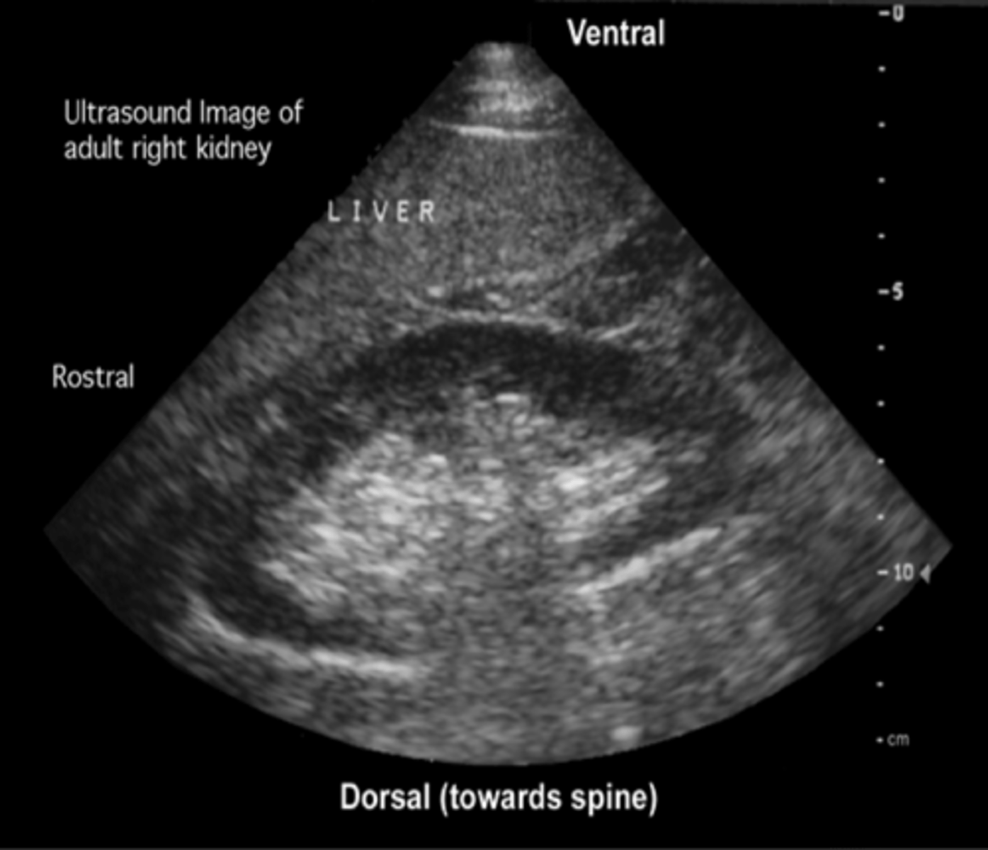 <p>Evaluates size and anatomy of kidney</p>