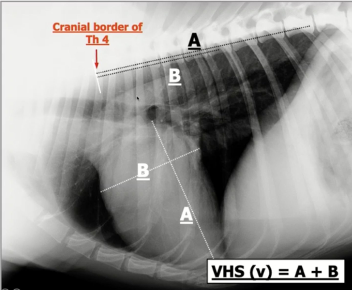 <p>1.) measure the long axis of the heart</p><p>2.) measure the short axis of the heart (width)</p><p>3.) interpose both measurements onto the vertebrae, starting at T4</p><p>4.) count each of the vertebrae that span over both measurements</p><p>5.) add the number of vertebrae for the long and short axis together</p>