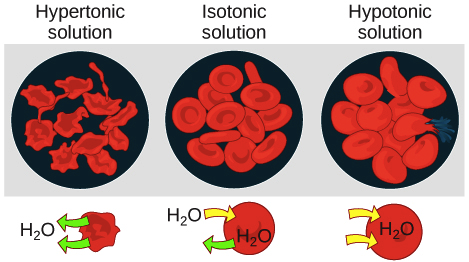 <p>HIGH SOLUTE CONC. OUTSIDE vs inside the cell<br>WATER MOVES OUT → causes cell to shrivel</p>