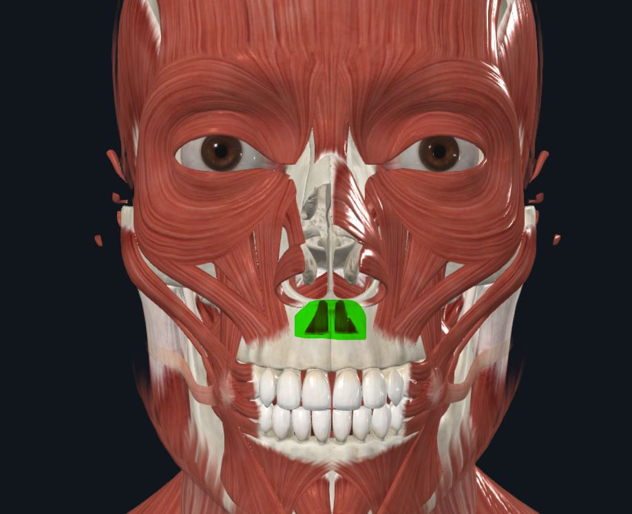 <p><strong>Nombre alterno: </strong>Incisal, Depresor del tabique nasal</p><p><strong><mark data-color="yellow" style="background-color: yellow; color: inherit">Origen: </mark></strong><mark data-color="yellow" style="background-color: yellow; color: inherit">Fosa Mirtiforme del maxilar y eminencia canina</mark></p><p><strong><mark data-color="blue" style="background-color: blue; color: inherit">Inserción: </mark></strong><mark data-color="blue" style="background-color: blue; color: inherit">Ala y tabiqu</mark><strong><mark data-color="blue" style="background-color: blue; color: inherit">e </mark></strong><mark data-color="blue" style="background-color: blue; color: inherit">de la nariz y M. Transverso de la nariz</mark></p><p><strong><mark data-color="red" style="background-color: red; color: inherit">Acción: </mark></strong><mark data-color="red" style="background-color: red; color: inherit">Deprime la punta de la nariz (Constrictor), Deprime labio superior</mark></p><p><strong><mark data-color="purple" style="background-color: purple; color: inherit">Inervación: </mark></strong><mark data-color="purple" style="background-color: purple; color: inherit">Nervio&nbsp;Facial</mark><strong><br><mark data-color="green" style="background-color: green; color: inherit">Relaciones: </mark></strong><mark data-color="green" style="background-color: green; color: inherit"><u>Cara superficial </u>en relación con el gingival y semiorbicular superior de los labios<br><u>Profunda </u>con Maxilar superior</mark></p><p><strong>Notas: </strong>Ubicado en área del bigote<br>Ocupa toda la fosa mirtiforme</p><ul><li><p>Parece el bigote de hitler</p></li></ul><p></p>