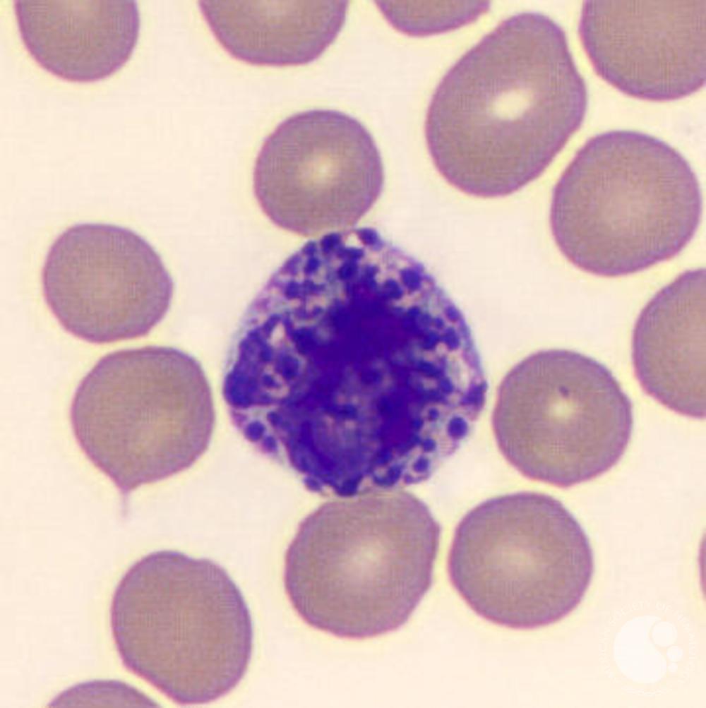 <ul><li><p>size: 10-14 um</p></li><li><p>nucleus is coarse, clumped, and bilobed with dark granules</p></li><li><p>cytoplasm has purple-black granules</p></li><li><p>contains histamine and heparin used to respond to hypersensitive reactions</p></li></ul><p></p>