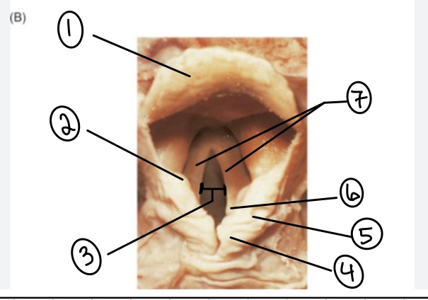<p>What is the term for the area above the epiglottis?</p>