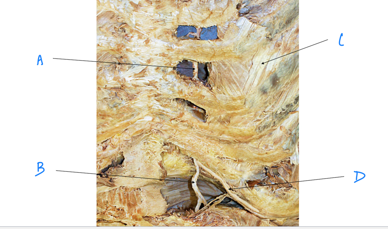 <p>B. Identify</p>