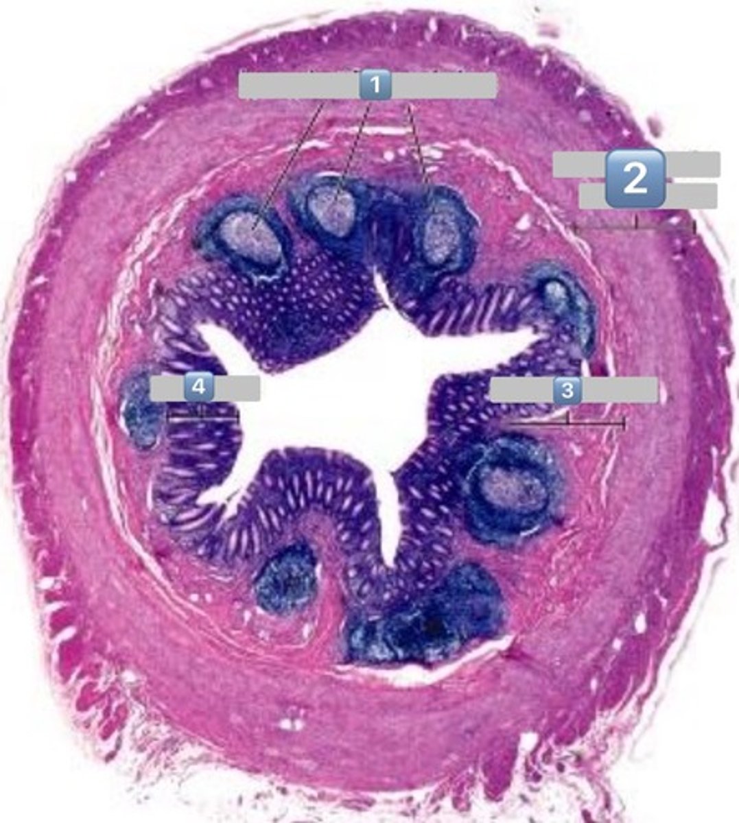 <p>lymphatic</p>