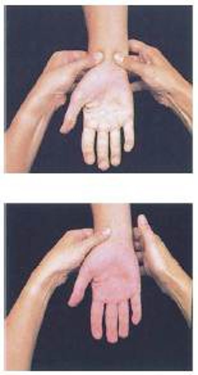 <p>compression of TFCC in supination</p>