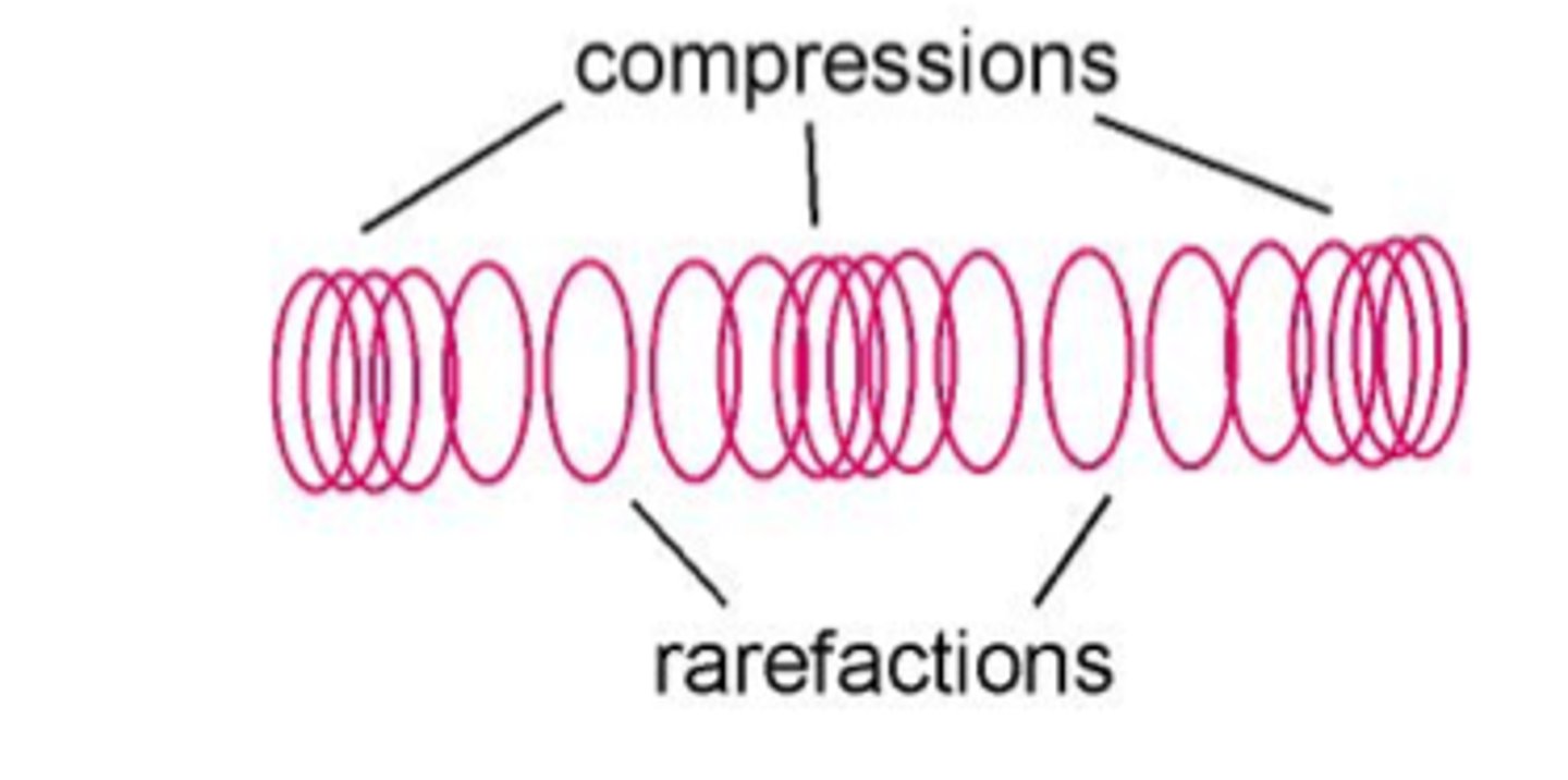 <p>The part of a longitudinal wave where the particles of the medium are close together.</p>