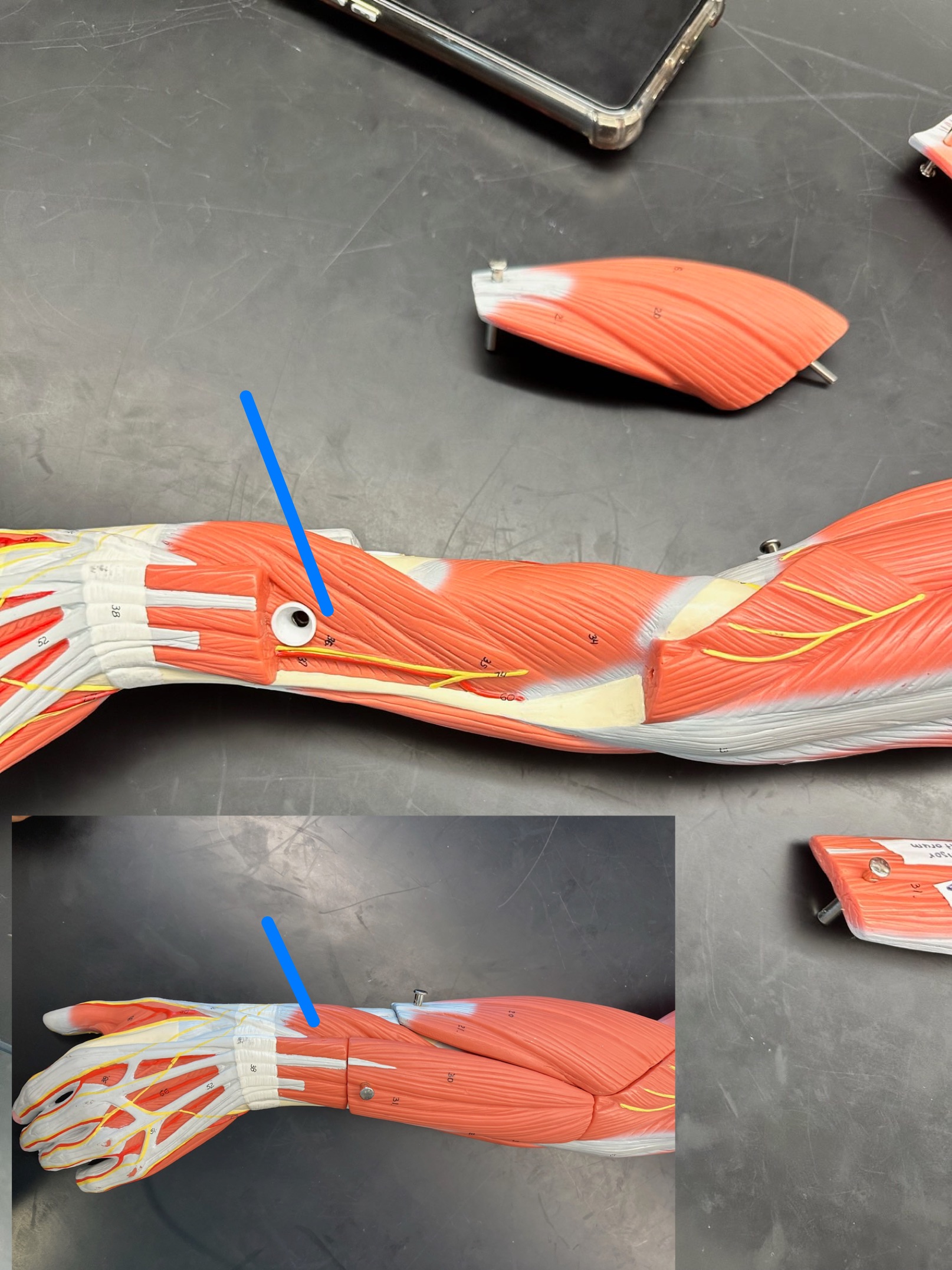 <p>ID muscle</p>
