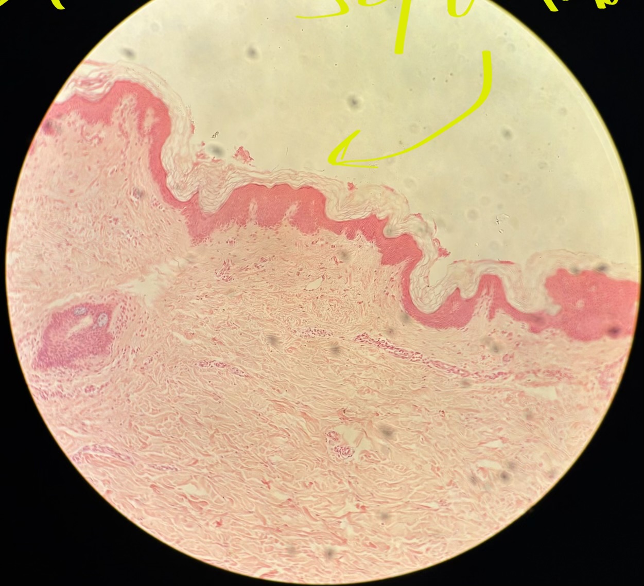 term image