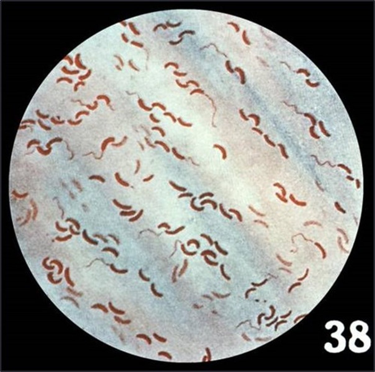 <p>This is an example of</p>