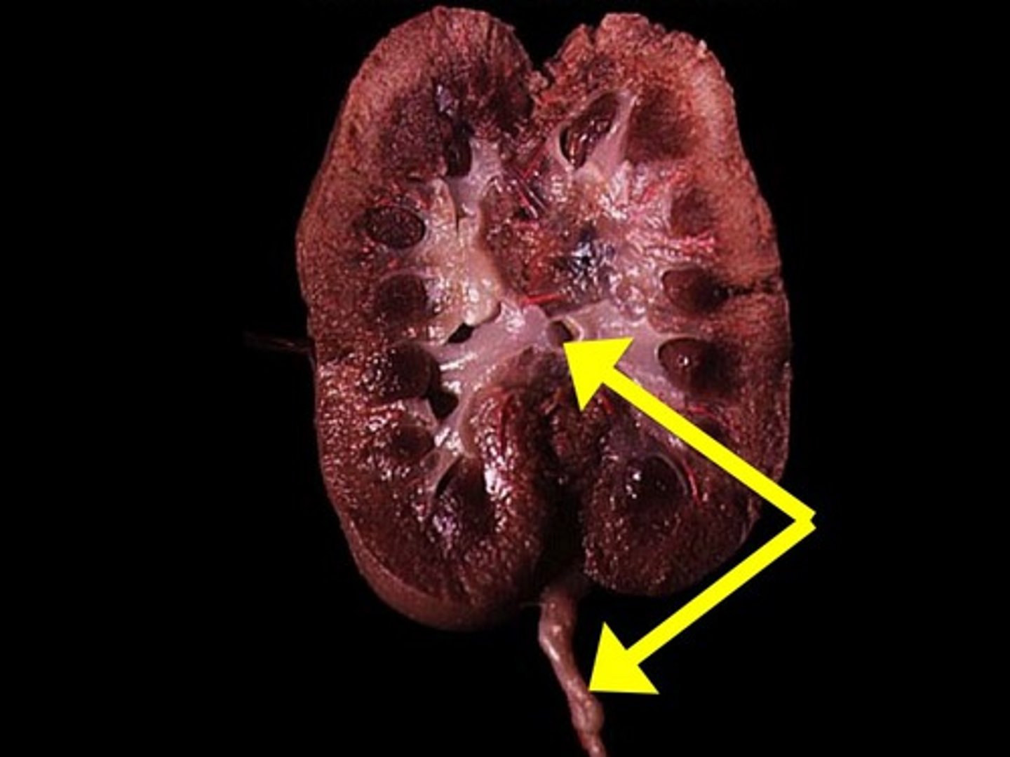 <p>A duct leading from the kidney to the urinary bladder.</p>