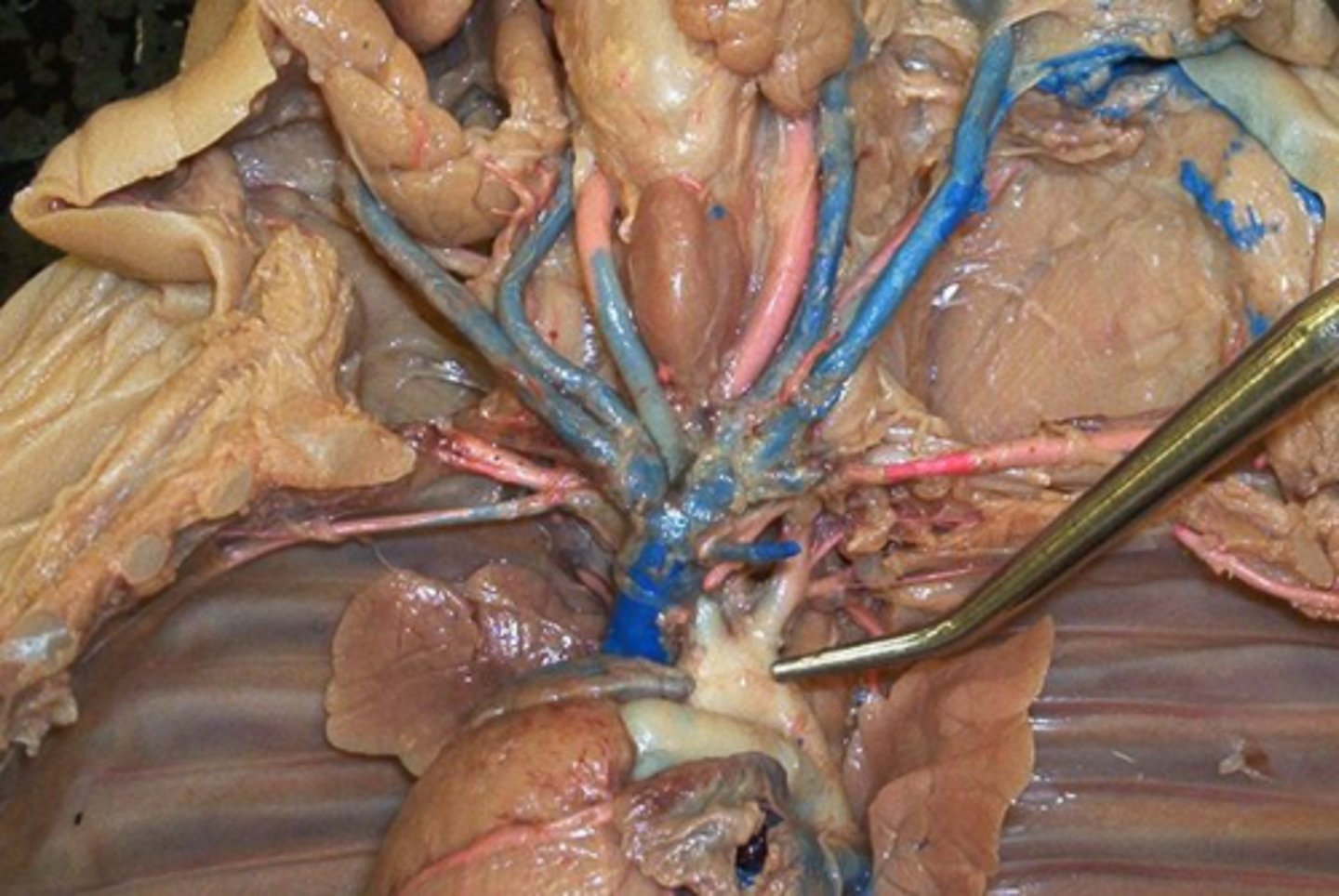 <p>Aortic arch</p>